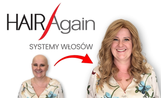 niechirurgiczny przeszczep włosów